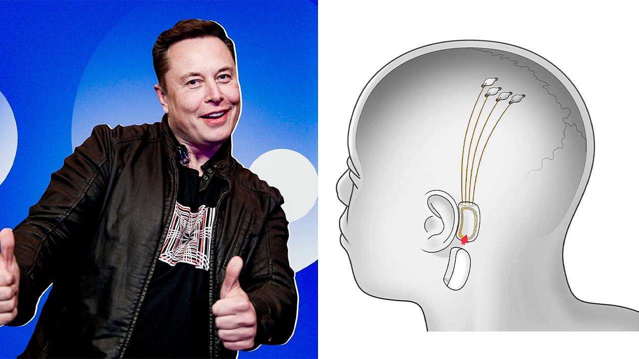 Elon Musk Says 6 Months to First Human Implant of Brain Interface